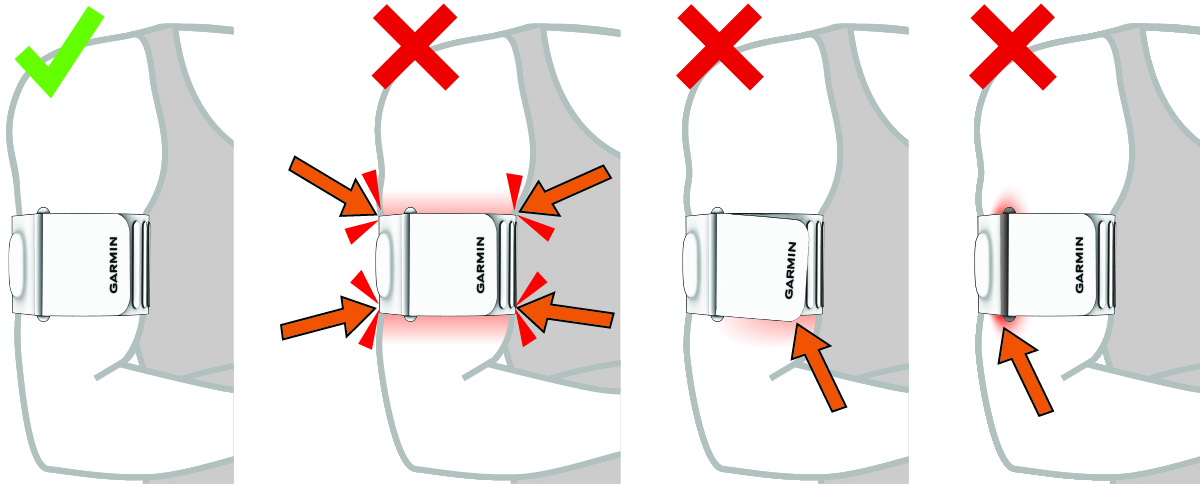 Az alvásfigyelő karkötő nem megfelelő elhelyezkedése